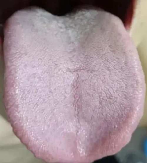 澳门49图库和舌根和牙龈被缝一起与舌根和牙龈被缝一起怎么办