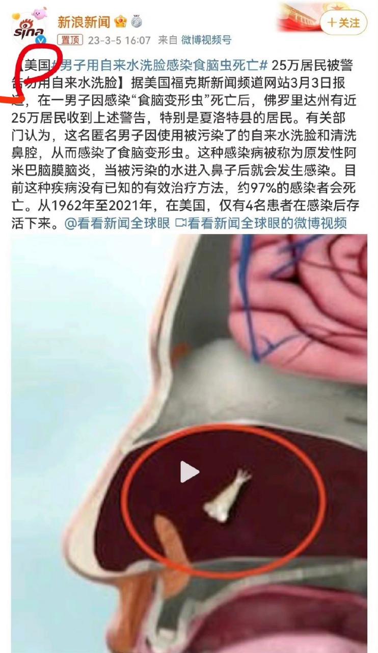 澳门今晚开奖结果+开奖记录和自来水中含活体虫与自来水中含活体虫吗